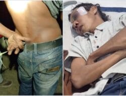 Warga Rempang Tolak PSN Diduga Diserang Petugas: Astaga!, Ada yang Terkena Panah dan Pecah Kepala