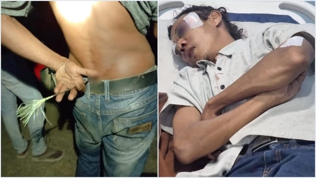 Warga Rempang Tolak PSN Diduga Diserang Petugas: Astaga!, Ada yang Terkena Panah dan Pecah Kepala